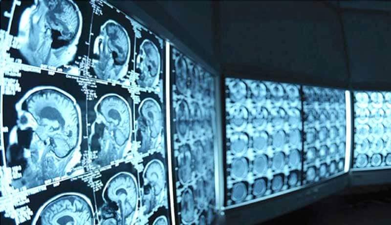 Een kamer vol met schermen met afbeeldingen van hersenscans