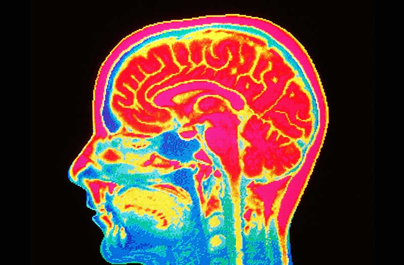 Een gekleurde afbeelding van de binnenkant van een menselijk hoofd