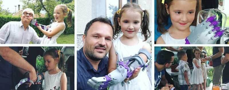 A man and a girl with a prosthetic arm