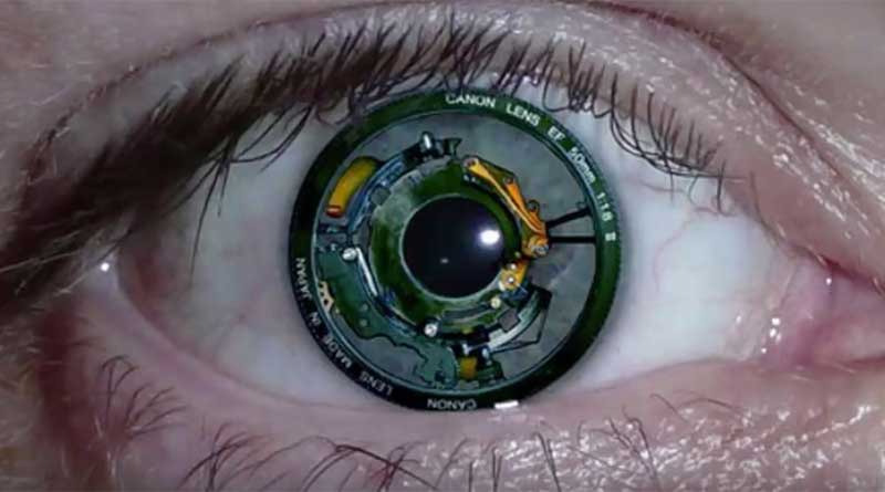 A human eye with a bionic implant