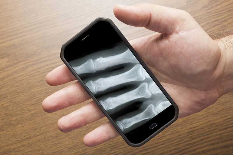 Man’s hand holding a smartphone showing X-ray of his fingers