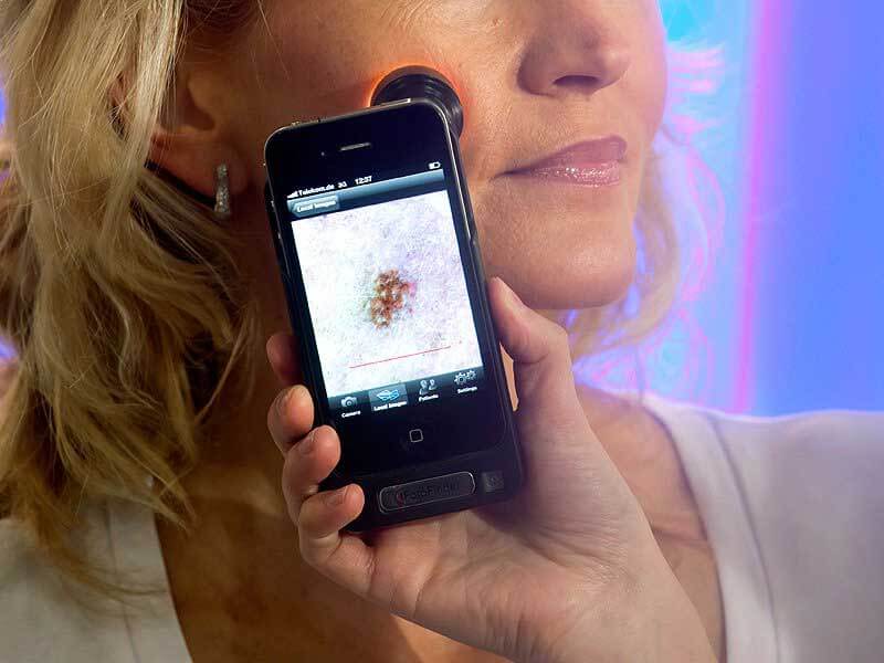 Hand holding a smartphone with a device attached that’s pressed down onto a woman’s face